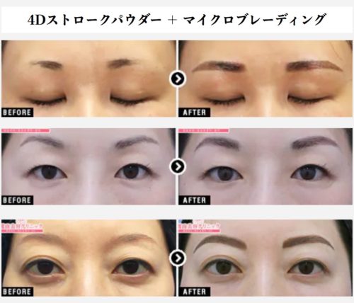 新宿の眉毛アートメイクができるクリニック10選 料金が安いランキング 眉毛アートメイクラボ 国内最大級のアートメイク専門メディア